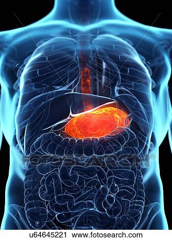 Diseased stomach, conceptual illustration View Large Photo Image Stock Image - Diseased stomach, conceptual illustration. Fotosearch