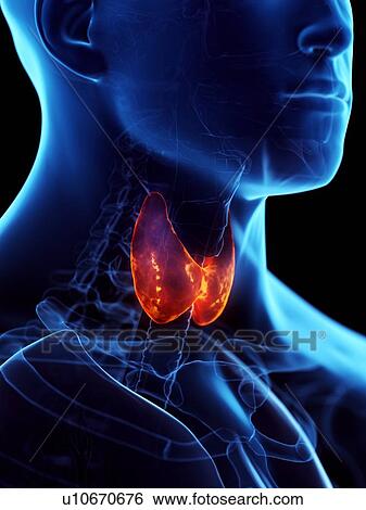Stock Photograph - Diseased thyroid gland, conceptual illustration. Fotosearch