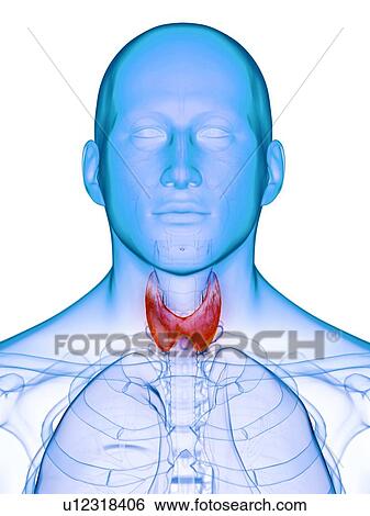 Stock Photograph - Diseased thyroid gland, conceptual illustration. Fotosearch
