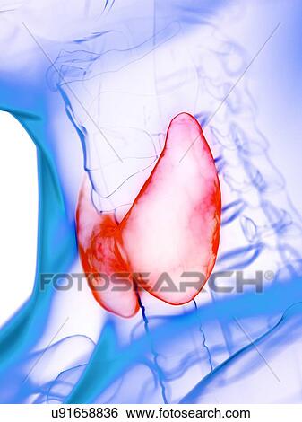 Stock Photograph - Diseased thyroid gland, conceptual illustration. Fotosearch
