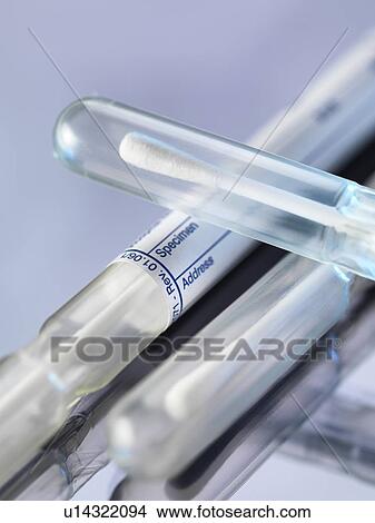 DNA evidence. DNA (deoxyribonucleic acid) swabs used for genetic testing. View Large Photo Image Picture - DNA evidence. DNA (deoxyribonucleic acid) swabs used for genetic testing.. Fotosearch