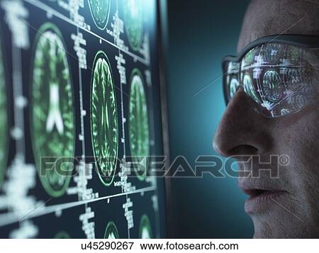 Stock Photo - Doctor examining magnetic resonance imaging (MRI) brain scans.. Fotosearch