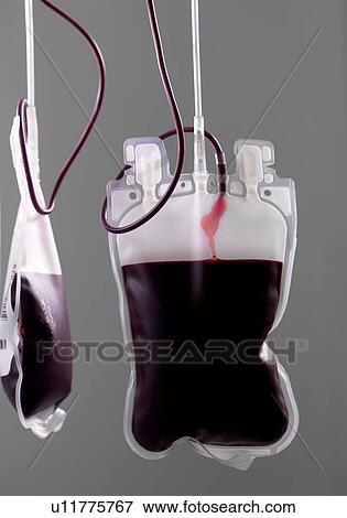 Donor blood processing. The donor blood is being separated into its component parts. View Large Photo Image Stock Photo - Donor blood processing. The donor blood is being separated into its component parts.. Fotosearch