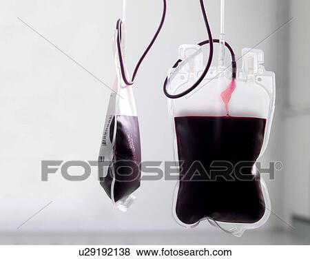 Stock Photo - Donor blood processing. The donor blood is being separated into its component parts.. Fotosearch