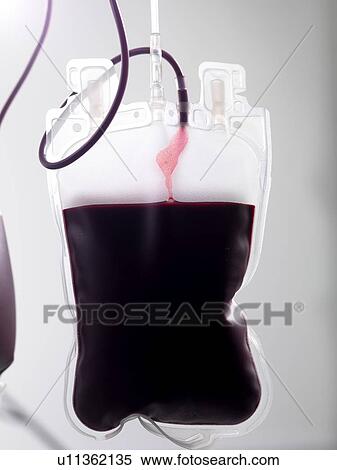 Stock Photography - Donor blood processing. The donor blood is being separated into its component parts.. Fotosearch