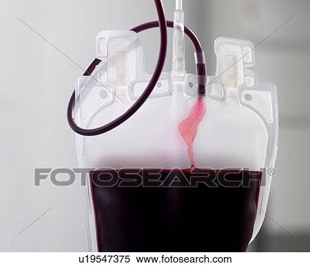 Stock Photography - Donor blood processing. The donor blood is being separated into its component parts.. Fotosearch