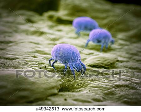 Dust mites, computer illustration. View Large Photo Image Stock Image - Dust mites, computer illustration.. Fotosearch