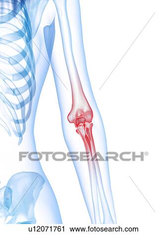 Elbow pain, conceptual illustration View Large Photo Image Stock Image - Elbow pain, conceptual illustration. Fotosearch