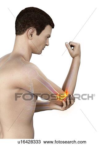 Elbow pain, conceptual illustration. View Large Photo Image Stock Image - Elbow pain, conceptual illustration.. Fotosearch