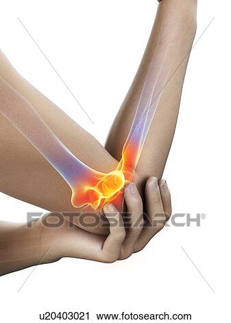 Elbow pain, conceptual illustration. View Large Photo Image Stock Image - Elbow pain, conceptual illustration.. Fotosearch