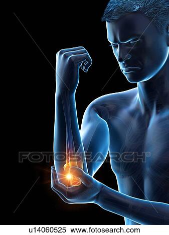 Elbow pain, conceptual illustration. View Large Photo Image Stock Photography - Elbow pain, conceptual illustration.. Fotosearch