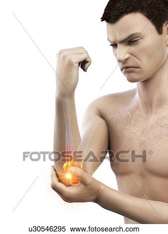 Elbow pain, conceptual illustration. View Large Photo Image Stock Photography - Elbow pain, conceptual illustration.. Fotosearch