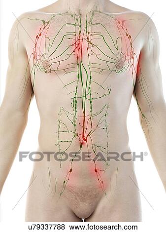 Stock Photo - Enlarged lymph nodes, conceptual computer illustration.. Fotosearch