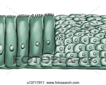 Epithelial metaplasia, computer illustration. Metaplasia is a change of cell type in a region. This illustration shows squamous metaplasia of respiratory epithelium, a consequence of cigarette smoking. View Large Photo Image Stock Image - Epithelial metaplasia, computer illustration. Metaplasia is a change of cell type in a region. This illustration shows squamous metaplasia of respiratory epithelium, a consequence of cigarette smoking.. Fotosearch