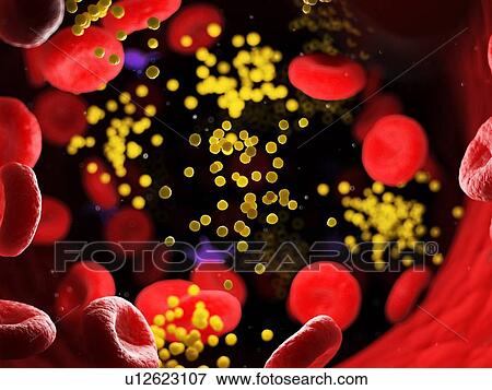 Stock Photo - Fat in blood vessels, computer illustration.. Fotosearch
