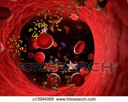 Stock Photo - Fat in blood vessels, computer illustration.. Fotosearch