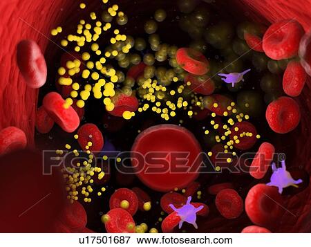 Stock Photo - Fat in blood vessels, computer illustration.. Fotosearch
