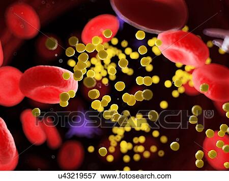 Stock Photo - Fat in blood vessels, computer illustration.. Fotosearch