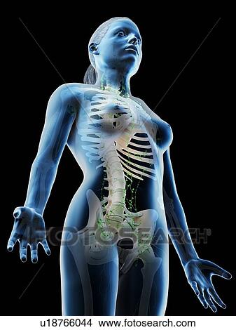 Picture - Female lymphatic system, computer illustration.. Fotosearch
