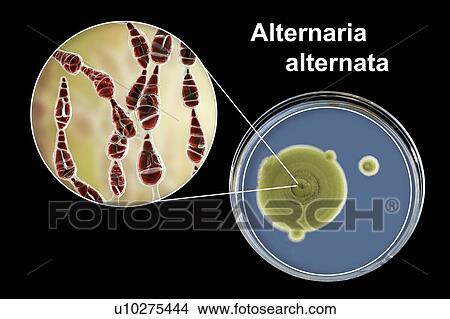 Filamentous allergenic fungus Alternaria alternata, computer illustration of fungal morphology and photograph of fungal colonies on Sabouraud Dextrose Agar. Alternaria is a dematiaceous (phaeoid) fungus commonly isolated from plants, soil, food, and... View Large Photo Image Picture - Filamentous allergenic fungus Alternaria alternata, computer illustration of fungal morphology and photograph of fungal colonies on Sabouraud Dextrose Agar. Alternaria is a dematiaceous (phaeoid) fungus commonly isolated from plants, soil, food, and.... Fotosearch