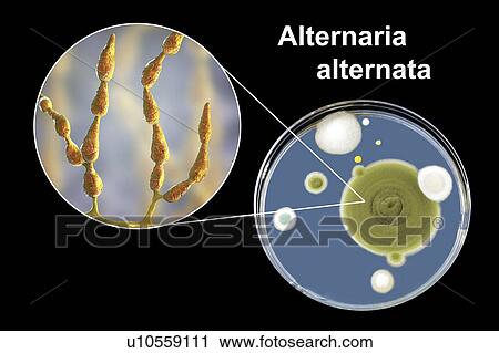 Filamentous allergenic fungus Alternaria alternata, computer illustration of fungal morphology and photograph of fungal colonies on Sabouraud Dextrose Agar. Alternaria is a dematiaceous (phaeoid) fungus commonly isolated from plants, soil, food, and... View Large Photo Image Stock Image - Filamentous allergenic fungus Alternaria alternata, computer illustration of fungal morphology and photograph of fungal colonies on Sabouraud Dextrose Agar. Alternaria is a dematiaceous (phaeoid) fungus commonly isolated from plants, soil, food, and.... Fotosearch