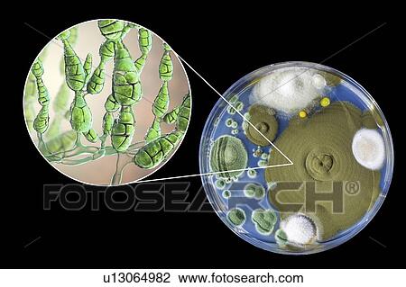 Filamentous allergenic fungus Alternaria alternata, computer illustration of fungal morphology and photograph of fungal colonies on Sabouraud Dextrose Agar. Alternaria is a dematiaceous (phaeoid) fungus commonly isolated from plants, soil, food, and... View Large Photo Image Stock Image - Filamentous allergenic fungus Alternaria alternata, computer illustration of fungal morphology and photograph of fungal colonies on Sabouraud Dextrose Agar. Alternaria is a dematiaceous (phaeoid) fungus commonly isolated from plants, soil, food, and.... Fotosearch