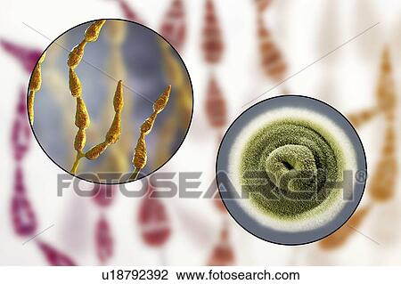 Filamentous allergenic fungus Alternaria alternata, computer illustration of fungal morphology and photograph of fungal colonies on Sabouraud Dextrose Agar. Alternaria is a dematiaceous (phaeoid) fungus commonly isolated from plants, soil, food, and... View Large Photo Image Stock Image - Filamentous allergenic fungus Alternaria alternata, computer illustration of fungal morphology and photograph of fungal colonies on Sabouraud Dextrose Agar. Alternaria is a dematiaceous (phaeoid) fungus commonly isolated from plants, soil, food, and.... Fotosearch