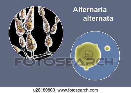 Stock Image - Filamentous allergenic fungus Alternaria alternata, computer illustration of fungal morphology and photograph of fungal colonies on Sabouraud Dextrose Agar. Alternaria is a dematiaceous (phaeoid) fungus commonly isolated from plants, soil, food, and.... Fotosearch