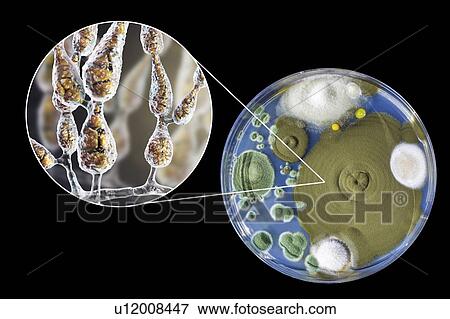 Stock Photo - Filamentous allergenic fungus Alternaria alternata, computer illustration of fungal morphology and photograph of fungal colonies on Sabouraud Dextrose Agar. Alternaria is a dematiaceous (phaeoid) fungus commonly isolated from plants, soil, food, and.... Fotosearch
