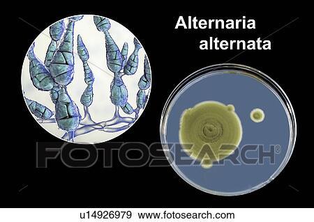 Stock Photo - Filamentous allergenic fungus Alternaria alternata, computer illustration of fungal morphology and photograph of fungal colonies on Sabouraud Dextrose Agar. Alternaria is a dematiaceous (phaeoid) fungus commonly isolated from plants, soil, food, and.... Fotosearch