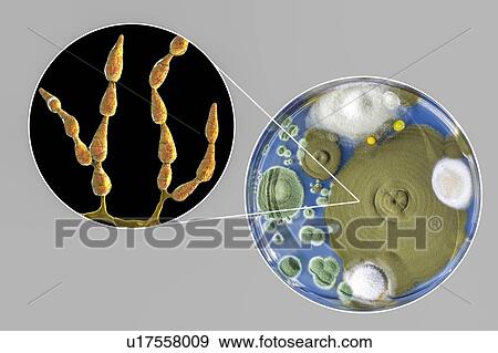 Filamentous allergenic fungus Alternaria alternata, computer illustration of fungal morphology and photograph of fungal colonies on Sabouraud Dextrose Agar. Alternaria is a dematiaceous (phaeoid) fungus commonly isolated from plants, soil, food, and... View Large Photo Image Stock Photo - Filamentous allergenic fungus Alternaria alternata, computer illustration of fungal morphology and photograph of fungal colonies on Sabouraud Dextrose Agar. Alternaria is a dematiaceous (phaeoid) fungus commonly isolated from plants, soil, food, and.... Fotosearch