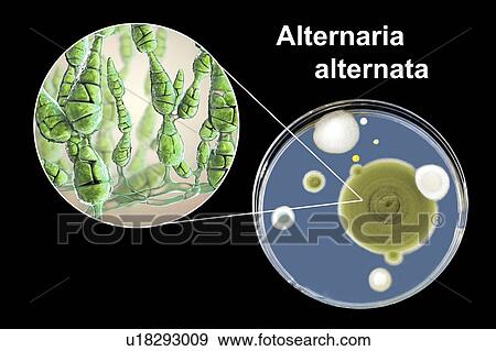 Stock Photo - Filamentous allergenic fungus Alternaria alternata, computer illustration of fungal morphology and photograph of fungal colonies on Sabouraud Dextrose Agar. Alternaria is a dematiaceous (phaeoid) fungus commonly isolated from plants, soil, food, and.... Fotosearch