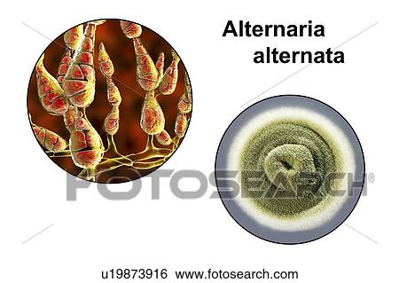 Stock Photograph - Filamentous allergenic fungus Alternaria alternata, computer illustration of fungal morphology and photograph of fungal colonies on Sabouraud Dextrose Agar. Alternaria is a dematiaceous (phaeoid) fungus commonly isolated from plants, soil, food, and.... Fotosearch