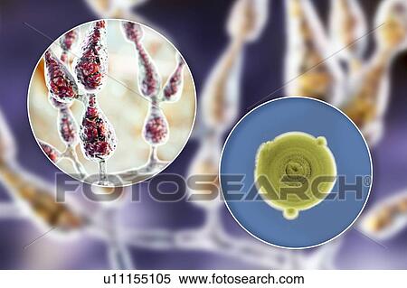 Stock Photography - Filamentous allergenic fungus Alternaria alternata, computer illustration of fungal morphology and photograph of fungal colonies on Sabouraud Dextrose Agar. Alternaria is a dematiaceous (phaeoid) fungus commonly isolated from plants, soil, food, and.... Fotosearch