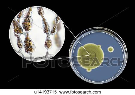 Filamentous allergenic fungus Alternaria alternata, computer illustration of fungal morphology and photograph of fungal colonies on Sabouraud Dextrose Agar. Alternaria is a dematiaceous (phaeoid) fungus commonly isolated from plants, soil, food, and... View Large Photo Image Stock Photography - Filamentous allergenic fungus Alternaria alternata, computer illustration of fungal morphology and photograph of fungal colonies on Sabouraud Dextrose Agar. Alternaria is a dematiaceous (phaeoid) fungus commonly isolated from plants, soil, food, and.... Fotosearch