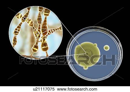 Stock Photography - Filamentous allergenic fungus Alternaria alternata, computer illustration of fungal morphology and photograph of fungal colonies on Sabouraud Dextrose Agar. Alternaria is a dematiaceous (phaeoid) fungus commonly isolated from plants, soil, food, and.... Fotosearch
