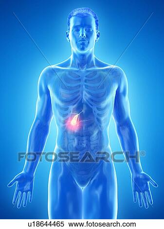 Gallbladder cancer, conceptual computer illustration. View Large Photo Image Stock Photography - Gallbladder cancer, conceptual computer illustration.. Fotosearch