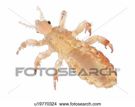 Head louse, computer illustration. View Large Photo Image Picture - Head louse, computer illustration.. Fotosearch