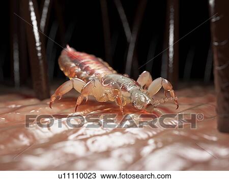 Stock Image - Head louse, computer illustration.. Fotosearch