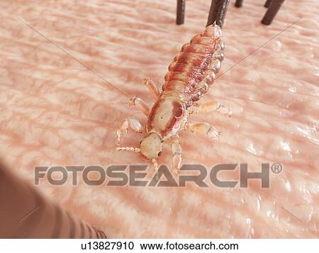 Head louse, computer illustration. View Large Photo Image Stock Image - Head louse, computer illustration.. Fotosearch
