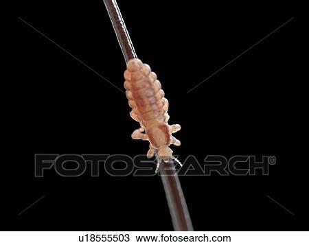 Stock Image - Head louse, computer illustration.. Fotosearch