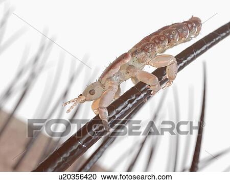 Head louse, computer illustration. View Large Photo Image Stock Image - Head louse, computer illustration.. Fotosearch