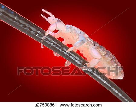 Stock Image - Head louse, computer illustration.. Fotosearch
