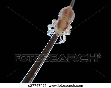 Stock Image - Head louse, computer illustration.. Fotosearch