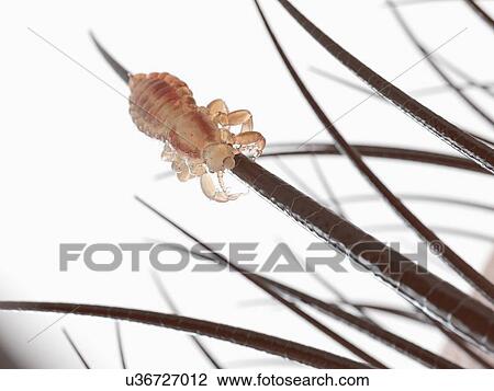 Head louse, computer illustration. View Large Photo Image Stock Image - Head louse, computer illustration.. Fotosearch