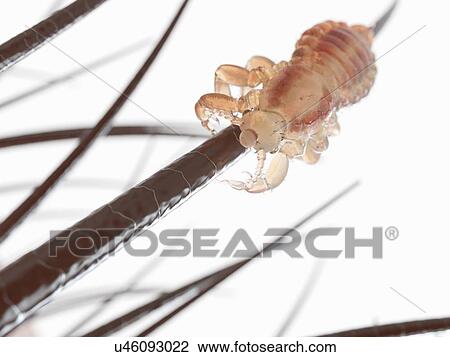Stock Image - Head louse, computer illustration.. Fotosearch