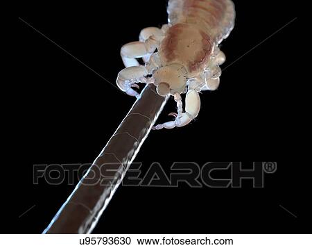 Stock Image - Head louse, computer illustration.. Fotosearch