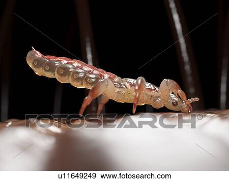 Stock Photo - Head louse, computer illustration.. Fotosearch