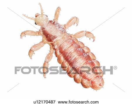 Stock Photo - Head louse, computer illustration.. Fotosearch