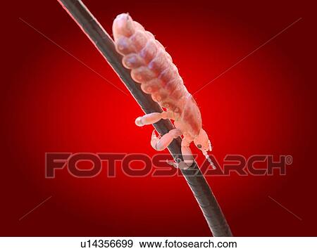 Stock Photo - Head louse, computer illustration.. Fotosearch